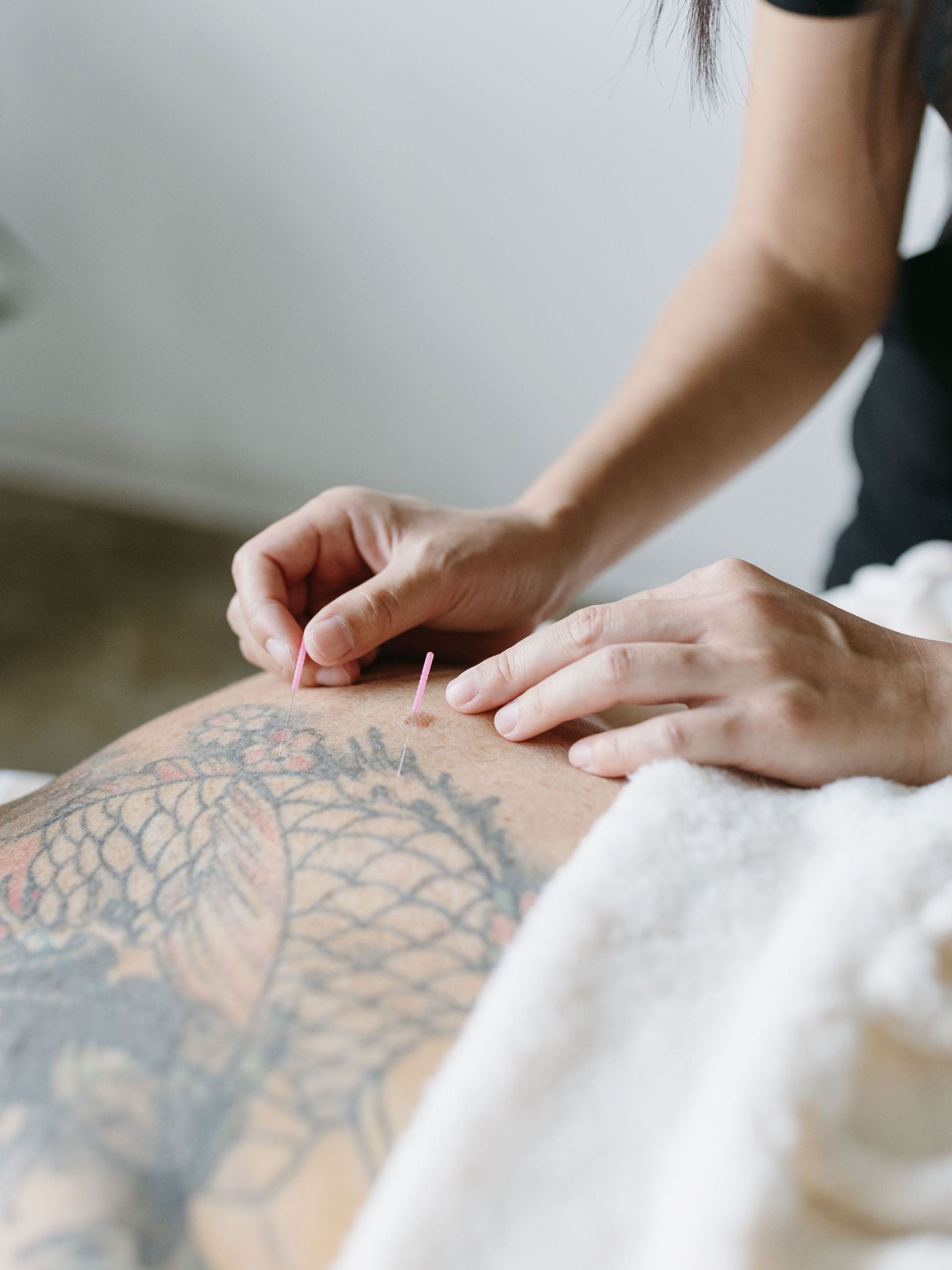 Acupuncture at Cherry Blossom Healing Arts Cherry Blossom Healing Arts Acupuncturist giving an acupuncture treatment